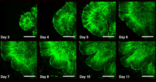 Fluorescence imaging of the organoid growing (Image: Weizmann Institute of Science)